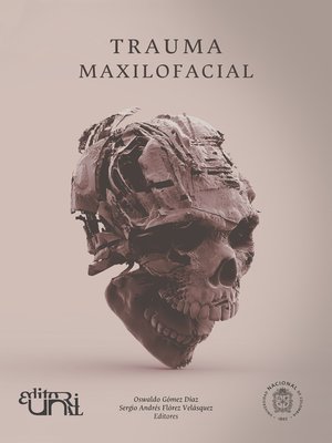 cover image of Trauma maxilofacial